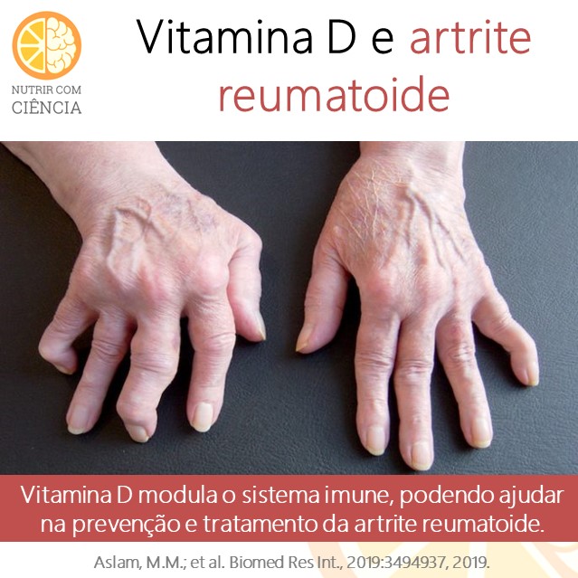 Vitamina D e artrite reumatoide